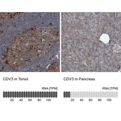 CDV3 Antibody, Novus Biologicals:Antibodies:Primary Antibodies